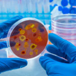 Scientist examines dengue virus on petri dish in laboratory, conceptual image